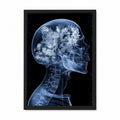 Floral X-Ray Skull Framed Wall Art