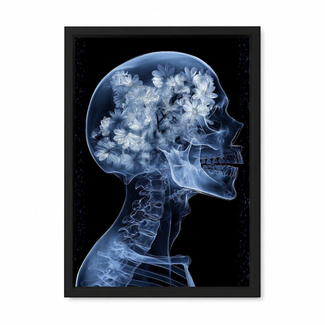 Floral X-Ray Skull Framed Wall Art